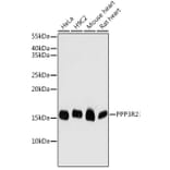 Western Blot - Anti-Calcineurin BII/PPP3R2 Antibody (A15740) - Antibodies.com