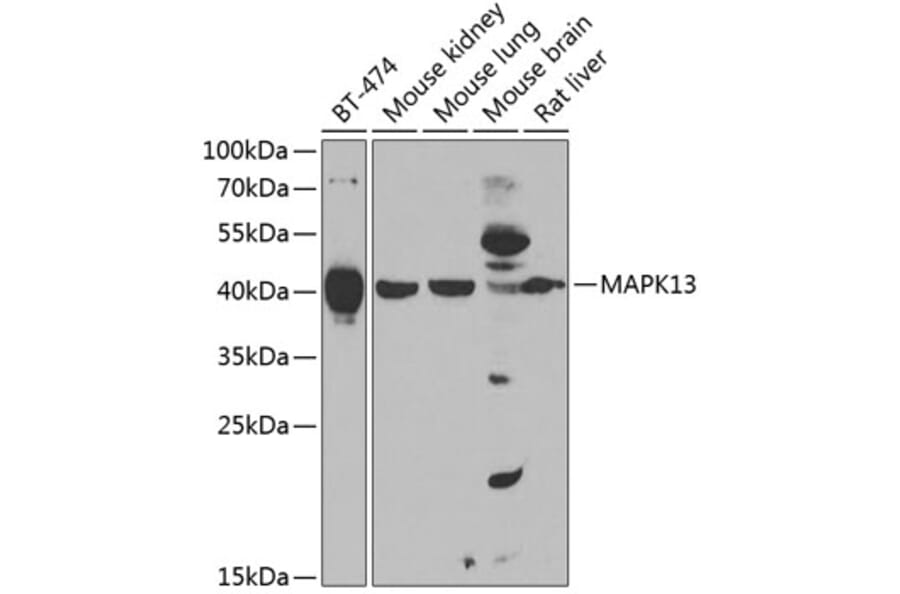 Western Blot - Anti-p38 delta/MAPK13 Antibody (A15741) - Antibodies.com