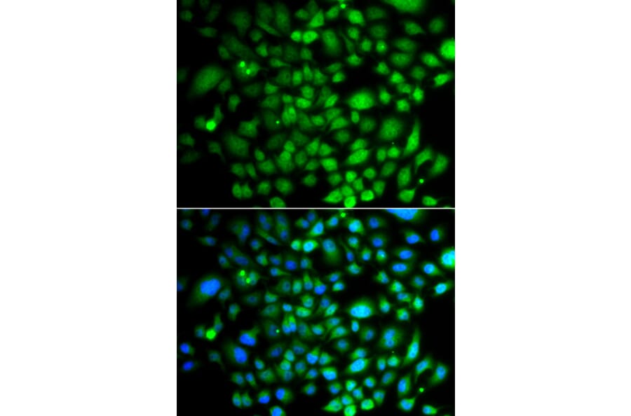 Immunofluorescence - Anti-Brk/PTK6 Antibody (A15742) - Antibodies.com