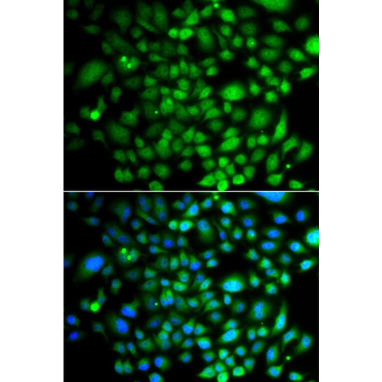 Immunofluorescence - Anti-Brk/PTK6 Antibody (A15742) - Antibodies.com