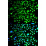 Immunofluorescence - Anti-Brk/PTK6 Antibody (A15742) - Antibodies.com
