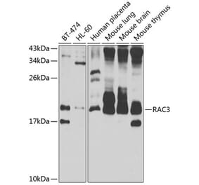 Western Blot - Anti-RAC3 Antibody (A15743) - Antibodies.com