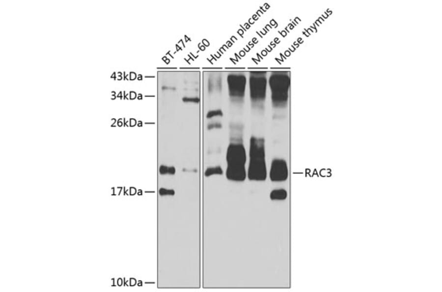 Western Blot - Anti-RAC3 Antibody (A15743) - Antibodies.com