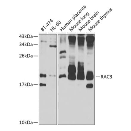 Western Blot - Anti-RAC3 Antibody (A15743) - Antibodies.com