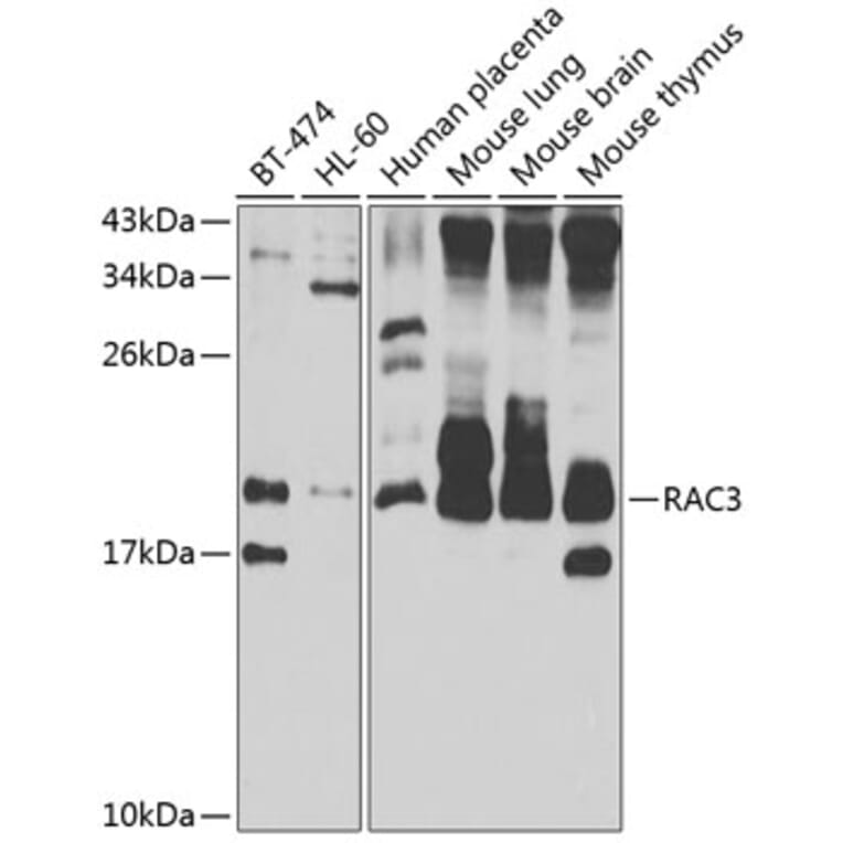 Western Blot - Anti-RAC3 Antibody (A15743) - Antibodies.com