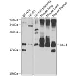 Western Blot - Anti-RAC3 Antibody (A15743) - Antibodies.com