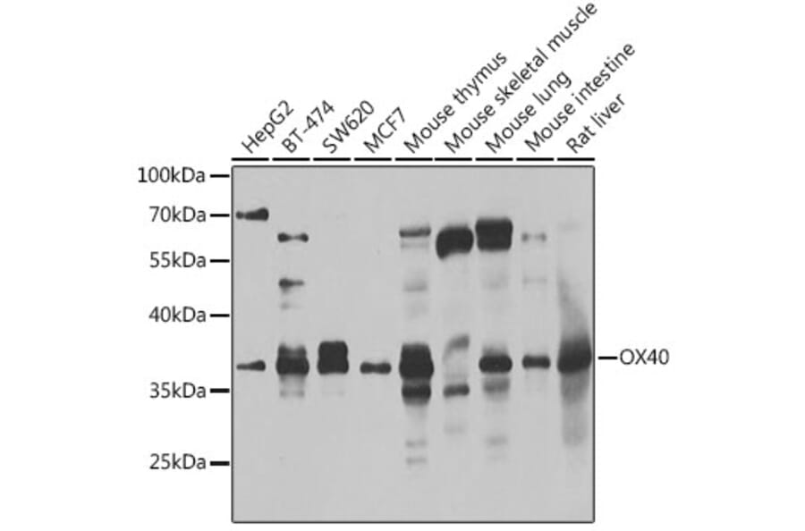 Western Blot - Anti-CD134/OX40L receptor Antibody (A15744) - Antibodies.com