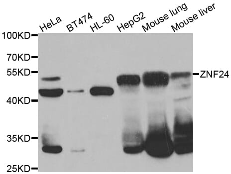 Western blot analysis of extracts of various cell lines, using Anti-ZNF24 Antibody (A7500) at 1:1,000 dilution.
Secondary antibody: Goat Anti-Rabbit IgG (H+L) (HRP) (AS014) at 1:10,000 dilution.
Lysates / proteins: 25µg per lane.
Blocking buffer: 3% non-fat dry milk in TBST.
Detection: ECL Enhanced Kit (RM00021).
Exposure time: 90s.