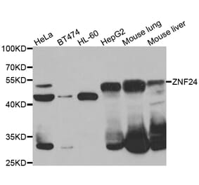 Western Blot - Anti-ZNF24 Antibody (A7500) - Antibodies.com
