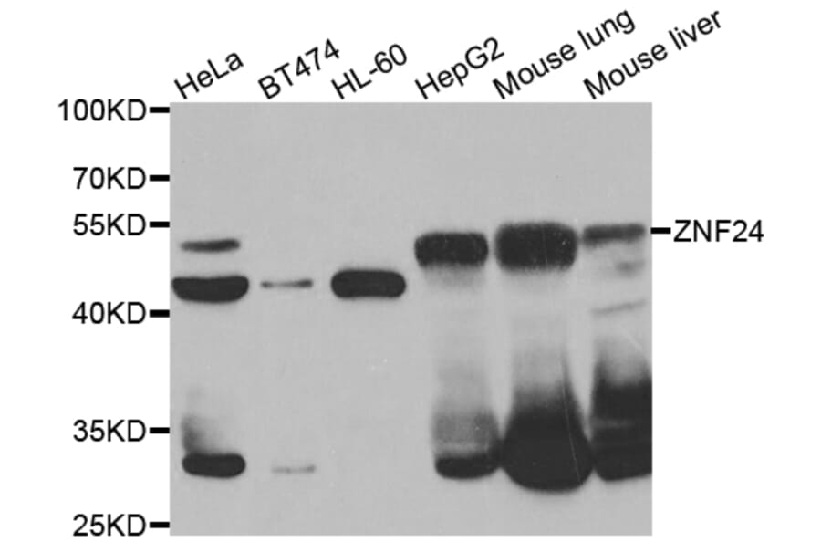 Western Blot - Anti-ZNF24 Antibody (A7500) - Antibodies.com