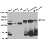 Western Blot - Anti-ZNF24 Antibody (A7500) - Antibodies.com