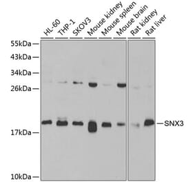 Western Blot - Anti-SNX3 Antibody (A15746) - Antibodies.com