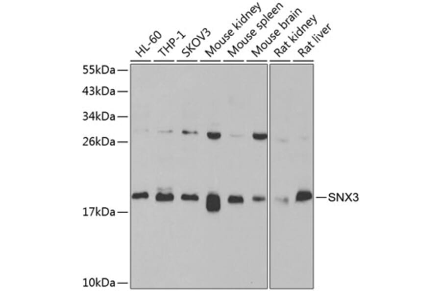 Western Blot - Anti-SNX3 Antibody (A15746) - Antibodies.com
