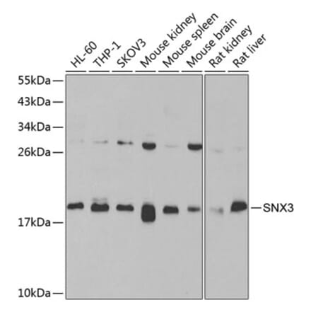 Western Blot - Anti-SNX3 Antibody (A15746) - Antibodies.com