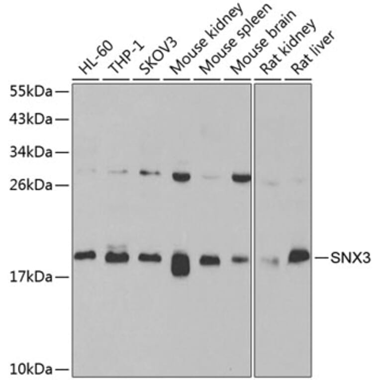 Western Blot - Anti-SNX3 Antibody (A15746) - Antibodies.com