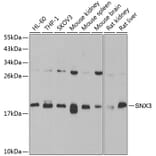 Western Blot - Anti-SNX3 Antibody (A15746) - Antibodies.com