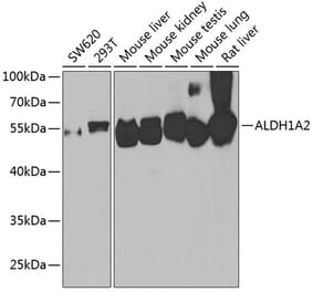 Western Blot - Anti-ALDH1A2 Antibody (A15747) - Antibodies.com
