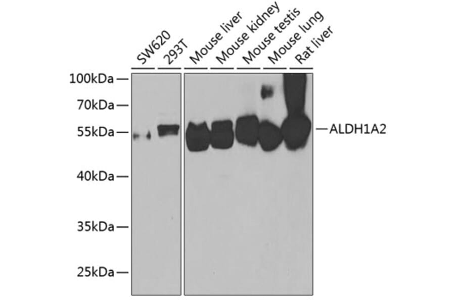 Western Blot - Anti-ALDH1A2 Antibody (A15747) - Antibodies.com