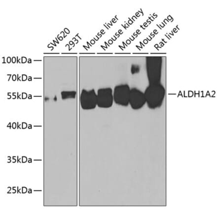 Western Blot - Anti-ALDH1A2 Antibody (A15747) - Antibodies.com