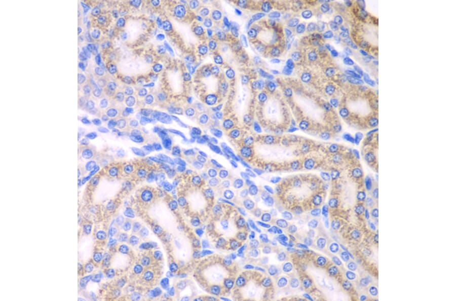 Immunohistochemistry - Anti-ALDH1A2 Antibody (A15747) - Antibodies.com