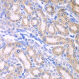 Immunohistochemistry - Anti-ALDH1A2 Antibody (A15747) - Antibodies.com
