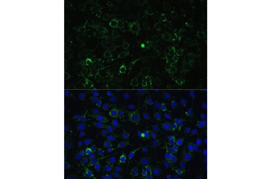 Immunofluorescence - Anti-ALDH1A2 Antibody (A15747) - Antibodies.com