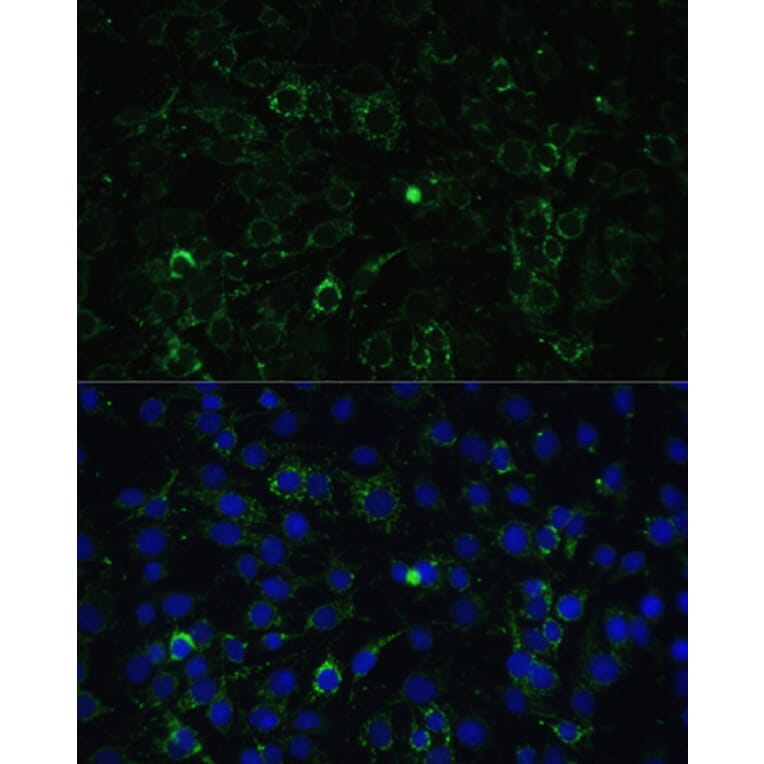 Immunofluorescence - Anti-ALDH1A2 Antibody (A15747) - Antibodies.com