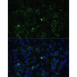 Immunofluorescence - Anti-ALDH1A2 Antibody (A15747) - Antibodies.com