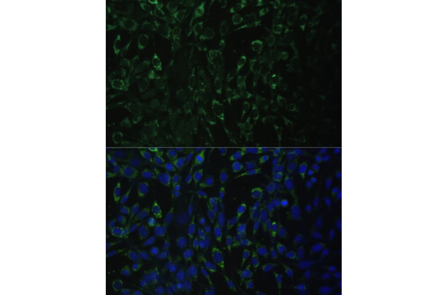 Immunofluorescence - Anti-ALDH1A2 Antibody (A15747) - Antibodies.com