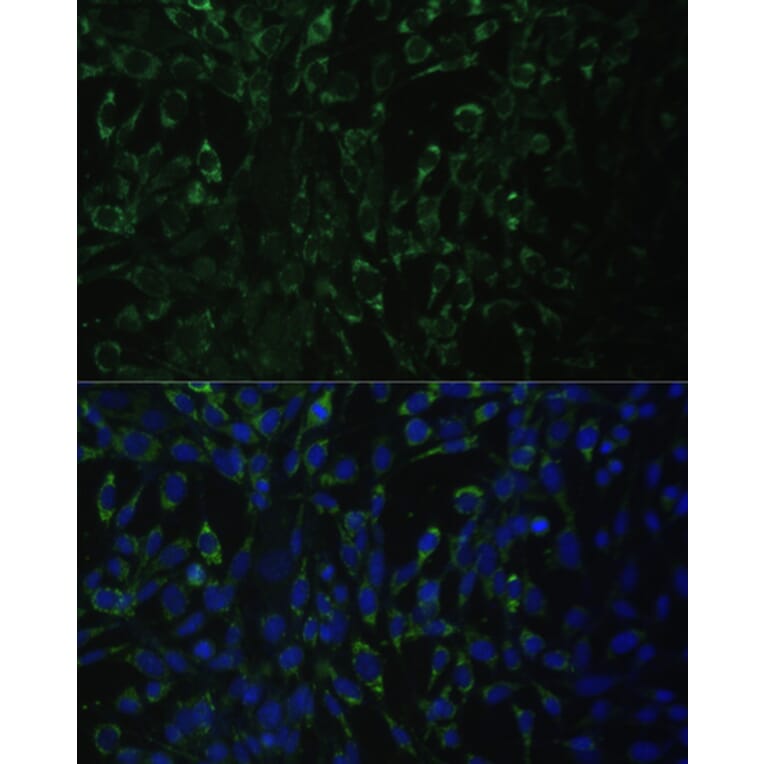 Immunofluorescence - Anti-ALDH1A2 Antibody (A15747) - Antibodies.com
