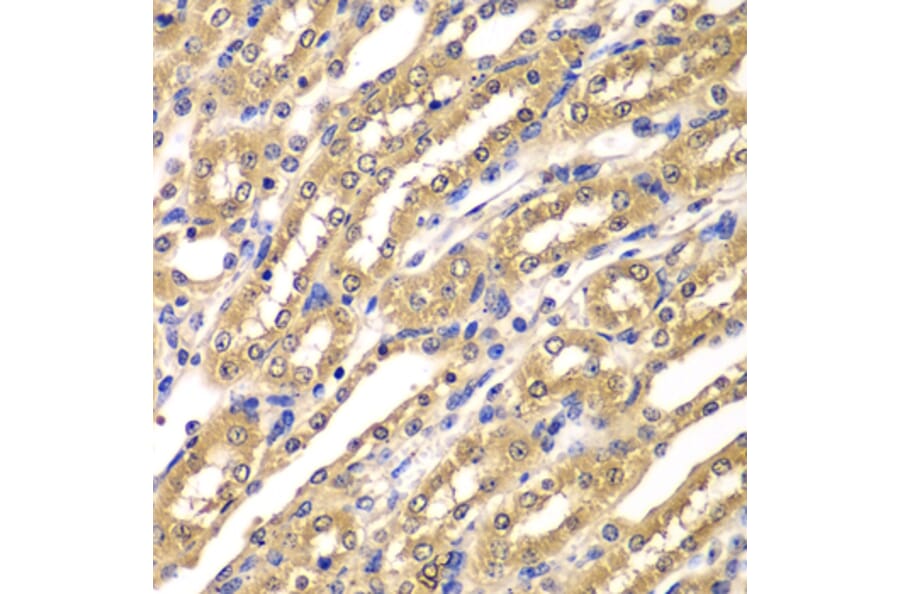 Immunohistochemistry - Anti-UBA3 Antibody (A7504) - Antibodies.com