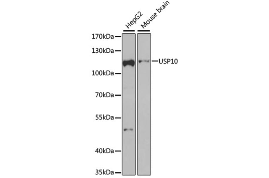 Western Blot - Anti-USP10 Antibody (A15749) - Antibodies.com