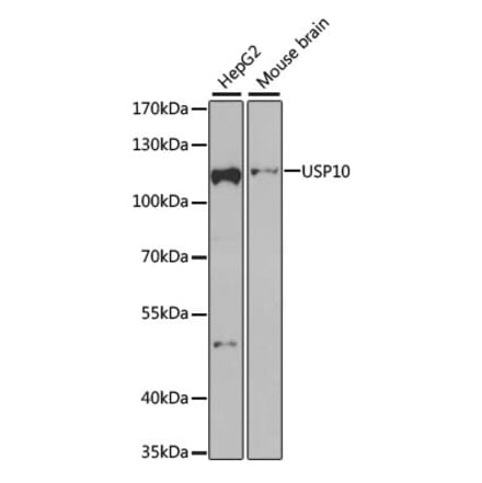 Western Blot - Anti-USP10 Antibody (A15749) - Antibodies.com