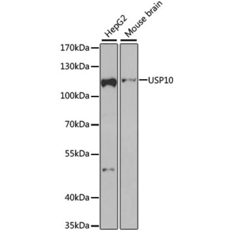 Western Blot - Anti-USP10 Antibody (A15749) - Antibodies.com