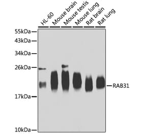 Western Blot - Anti-RAB31 Antibody (A15750) - Antibodies.com