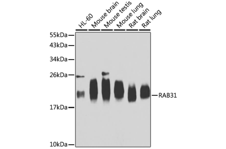 Western Blot - Anti-RAB31 Antibody (A15750) - Antibodies.com