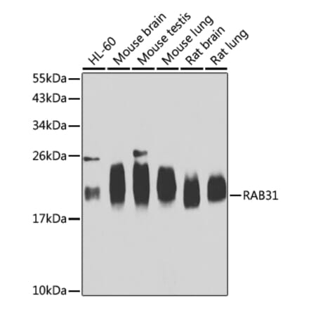 Western Blot - Anti-RAB31 Antibody (A15750) - Antibodies.com