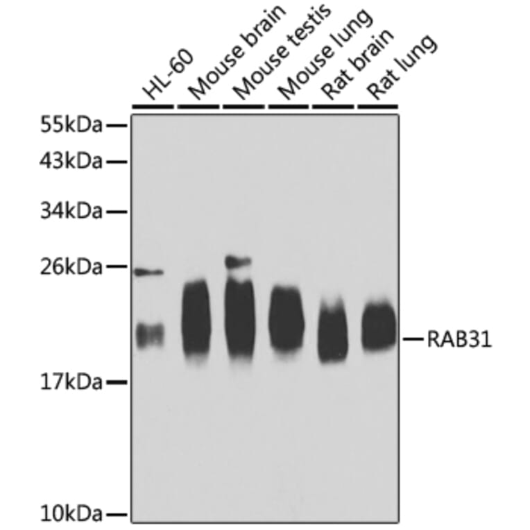 Western Blot - Anti-RAB31 Antibody (A15750) - Antibodies.com