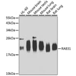 Western Blot - Anti-RAB31 Antibody (A15750) - Antibodies.com