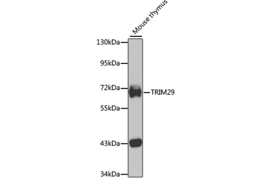 Western Blot - Anti-TRIM29 Antibody (A15751) - Antibodies.com