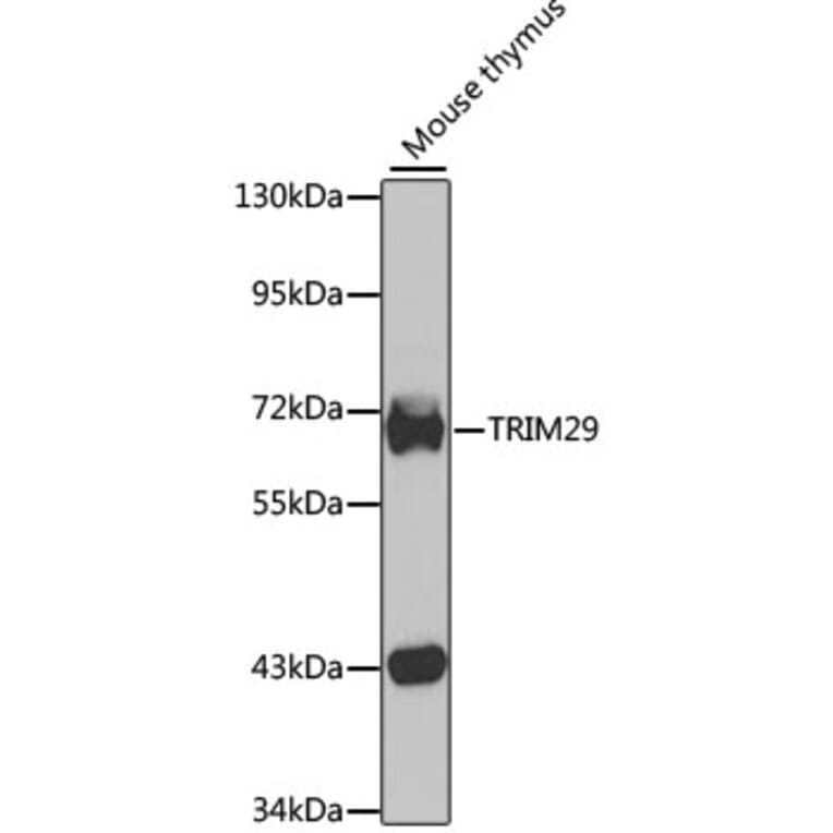 Western Blot - Anti-TRIM29 Antibody (A15751) - Antibodies.com