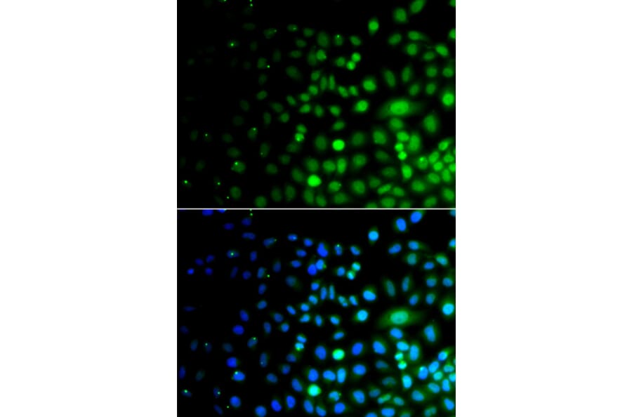 Immunofluorescence - Anti-Uba6 Antibody (A15752) - Antibodies.com