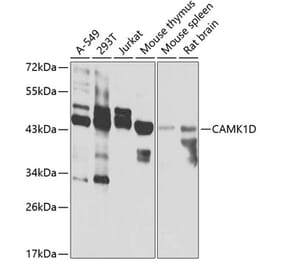 Western Blot - Anti-CAMK1D Antibody (A7512) - Antibodies.com