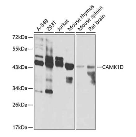 Western Blot - Anti-CAMK1D Antibody (A7512) - Antibodies.com