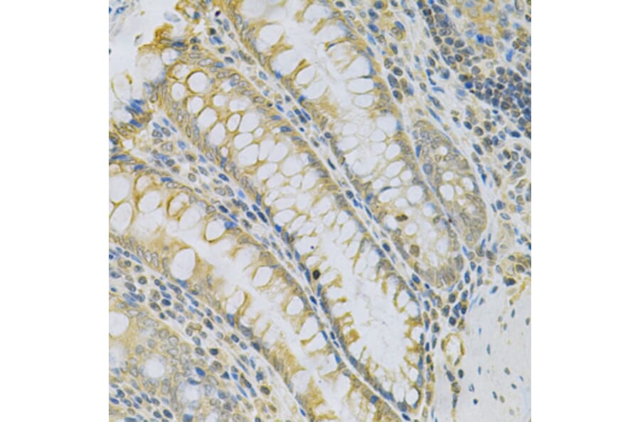 Immunohistochemistry - Anti-CAMK1D Antibody (A7512) - Antibodies.com