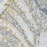 Immunohistochemistry - Anti-CAMK1D Antibody (A7512) - Antibodies.com