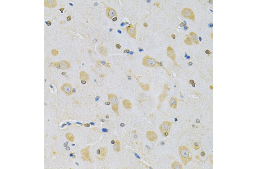 Immunohistochemistry - Anti-CAMK1D Antibody (A7512) - Antibodies.com