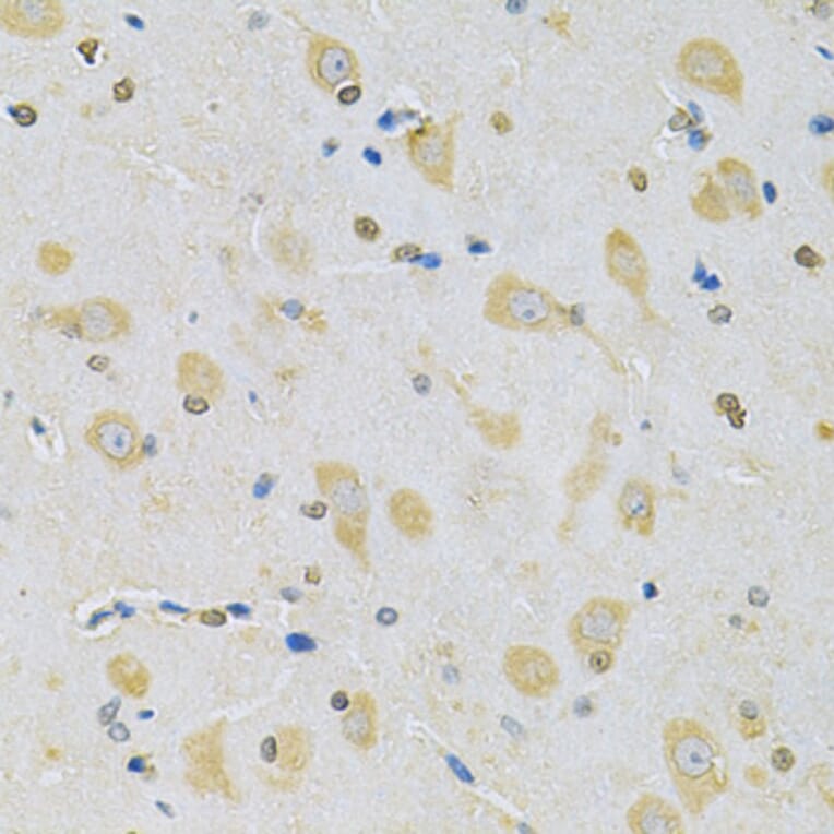 Immunohistochemistry - Anti-CAMK1D Antibody (A7512) - Antibodies.com