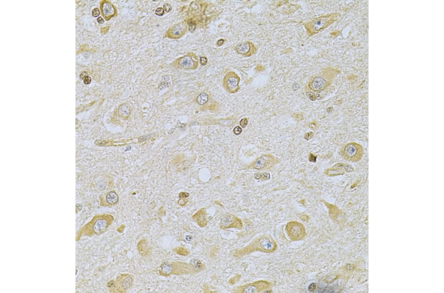 Immunohistochemistry - Anti-CAMK1D Antibody (A7512) - Antibodies.com