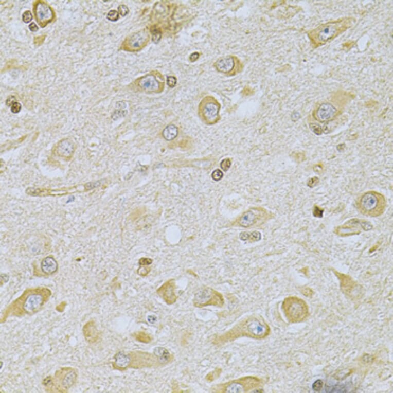 Immunohistochemistry - Anti-CAMK1D Antibody (A7512) - Antibodies.com